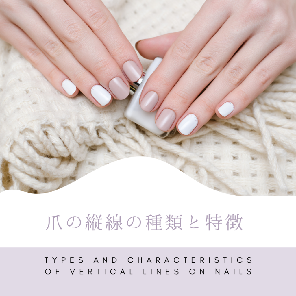 Types and characteristics of vertical lines on nails